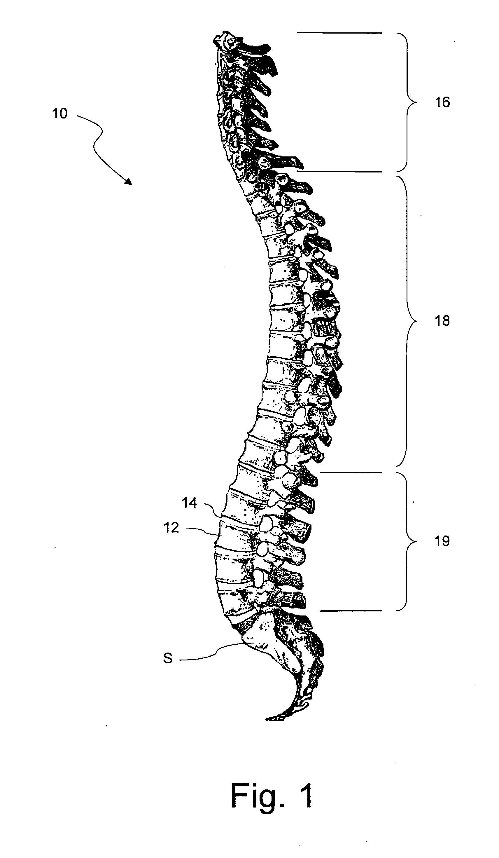 Computer program for spine mobility simulation and spine simulation method