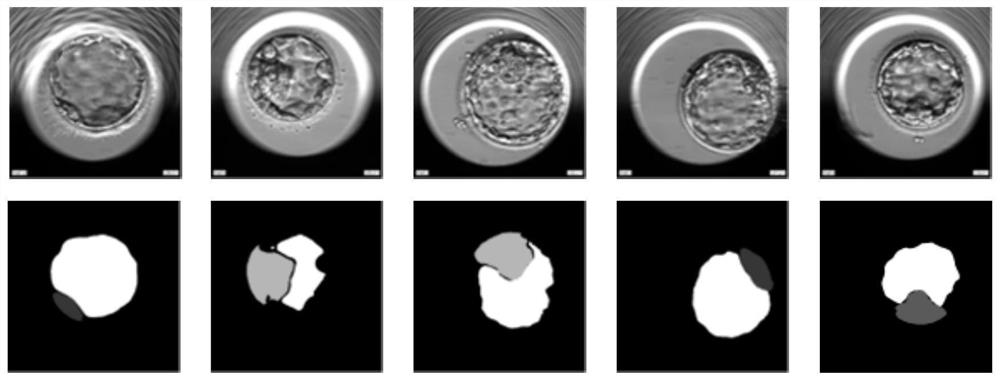 Embryo pregnancy state intelligent prediction method and system