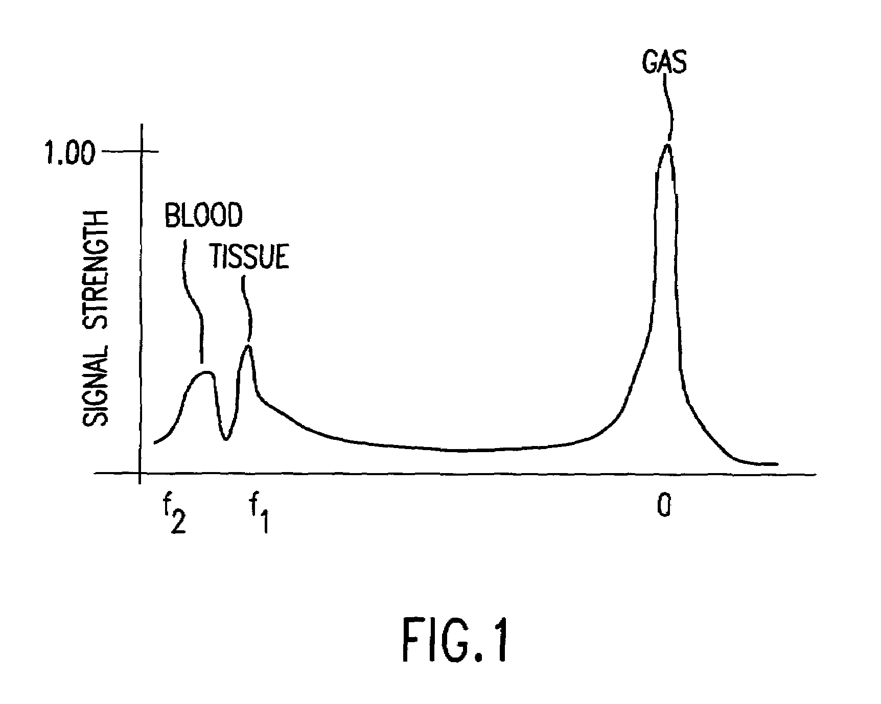 Methods for in vivo evaluation of physiological conditions and/or organ or system function including methods to evaluate cardiopulmonary disorders such as chronic heart failure using polarized 129 Xe