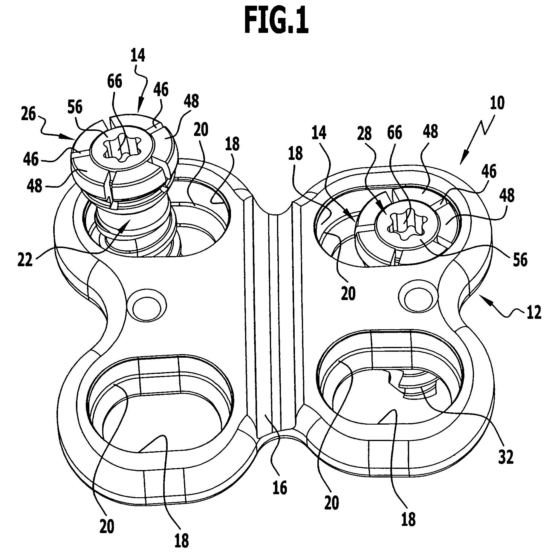 Bone screw