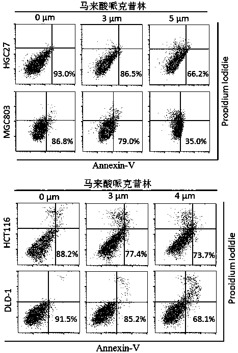 The application of combination of perhexiline and oxaliplatin in the treatment of gastric cancer and colorectal cancer