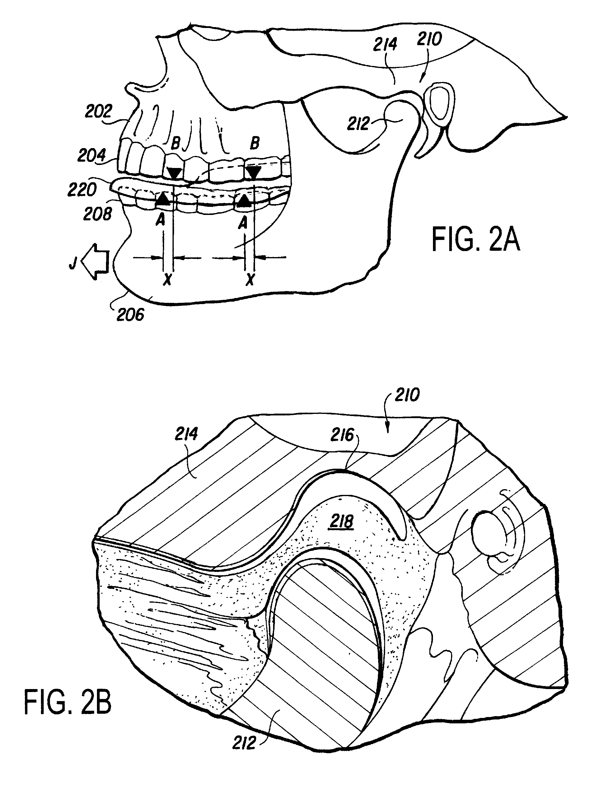 Musculoskeletal repositioning device