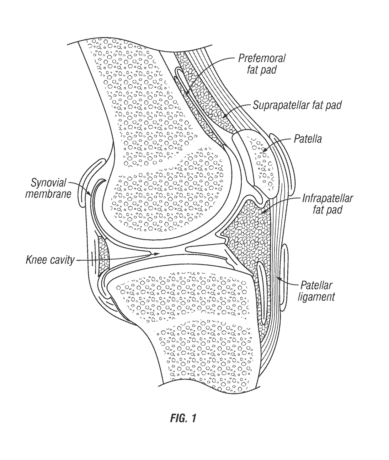 Joint fat pad formulations, and methods of use thereof