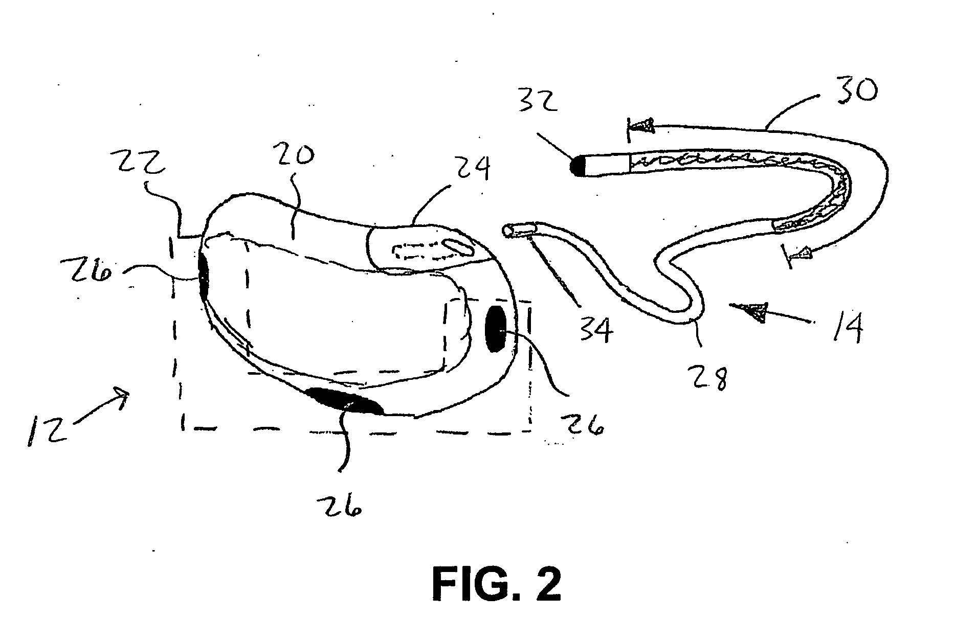 Method and system for aborting cardiac treatments