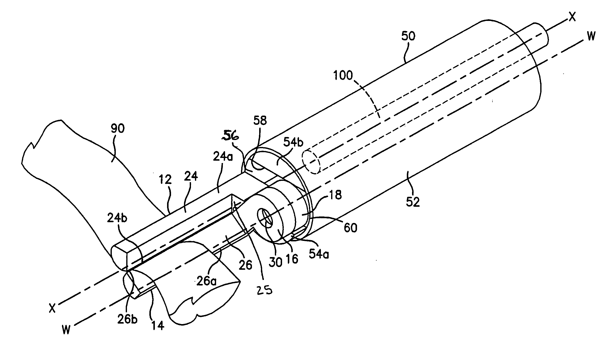 Ligation clip applier and method