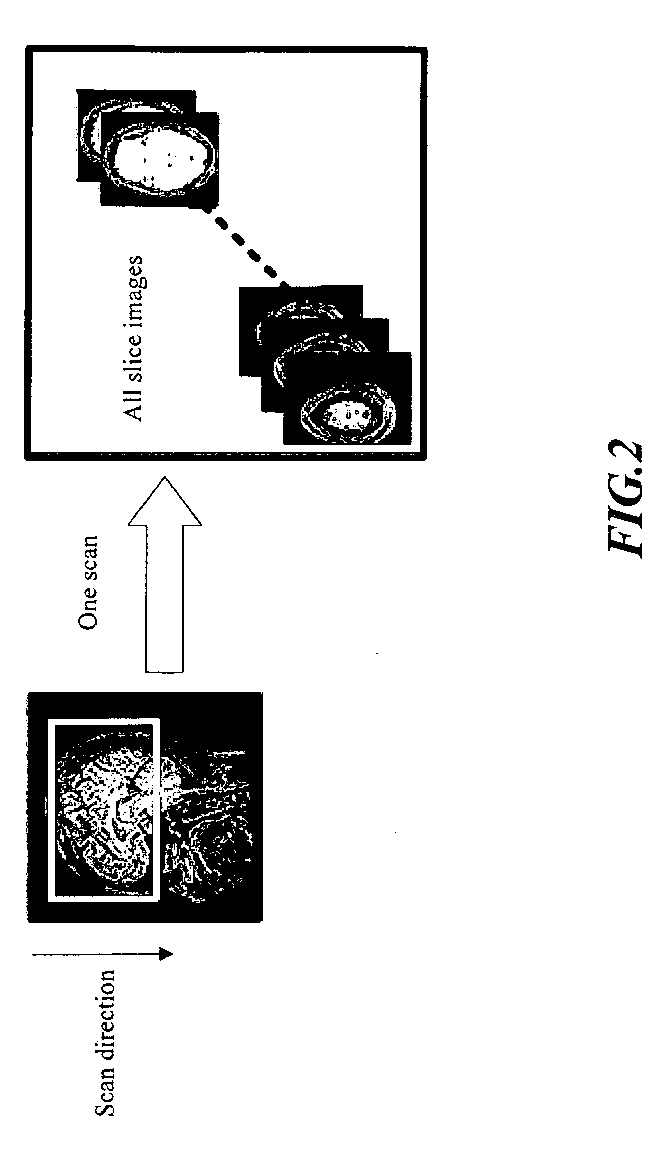 Method and apparatus for simultaneously acquiring multiple slices/slabs in magnetic resonance system