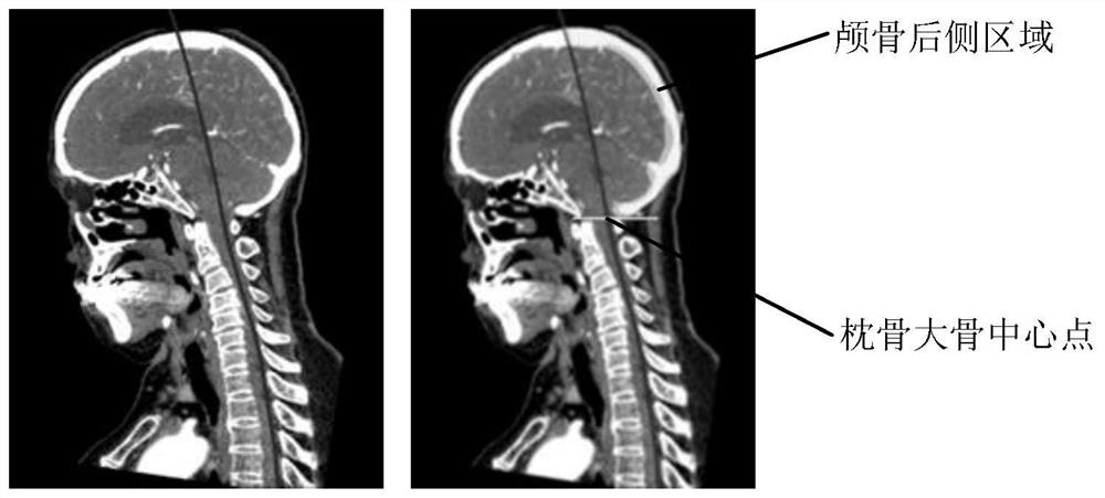 Spine detection method and device, electronic equipment and storage medium