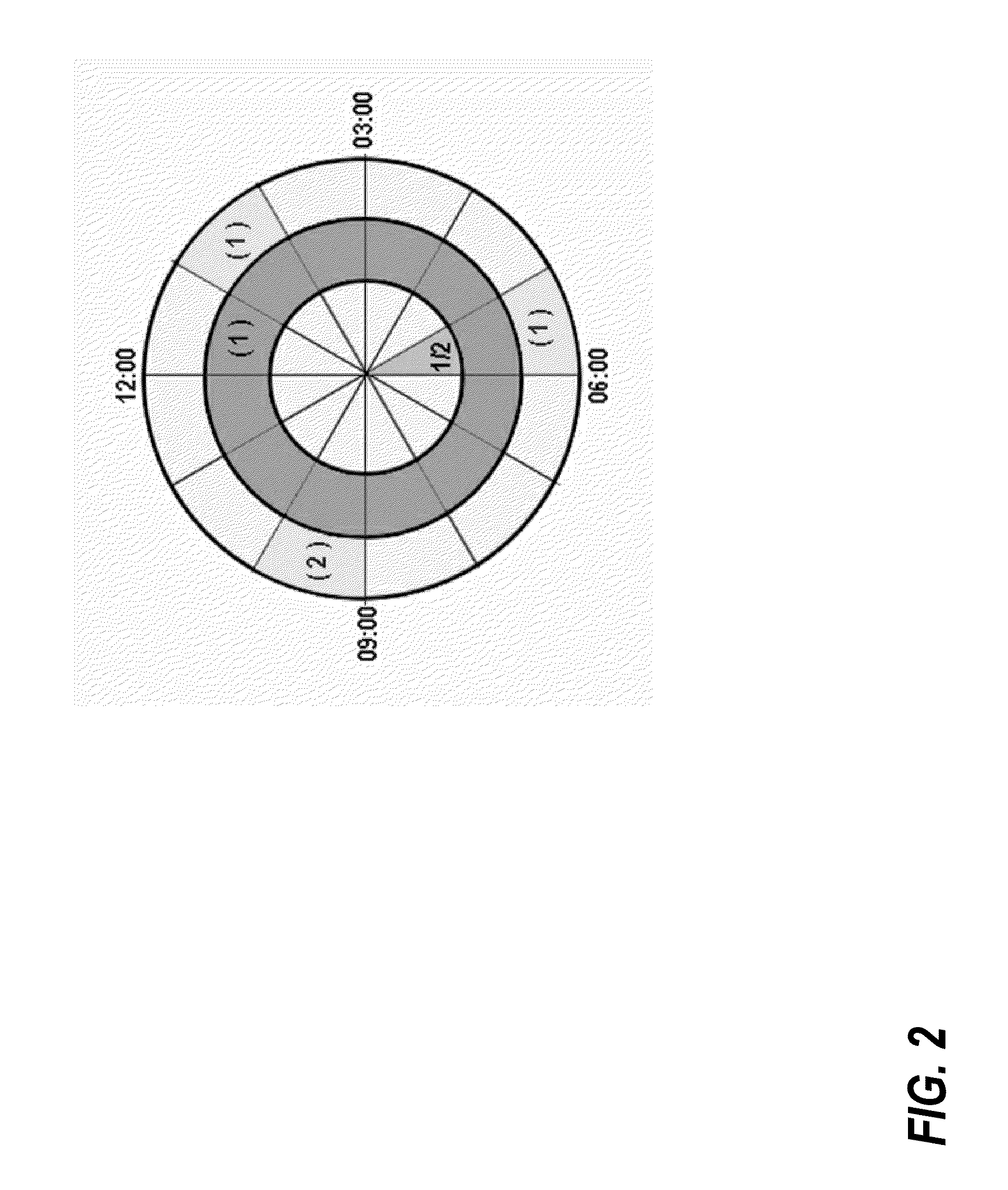 Radial view for display of temporal data