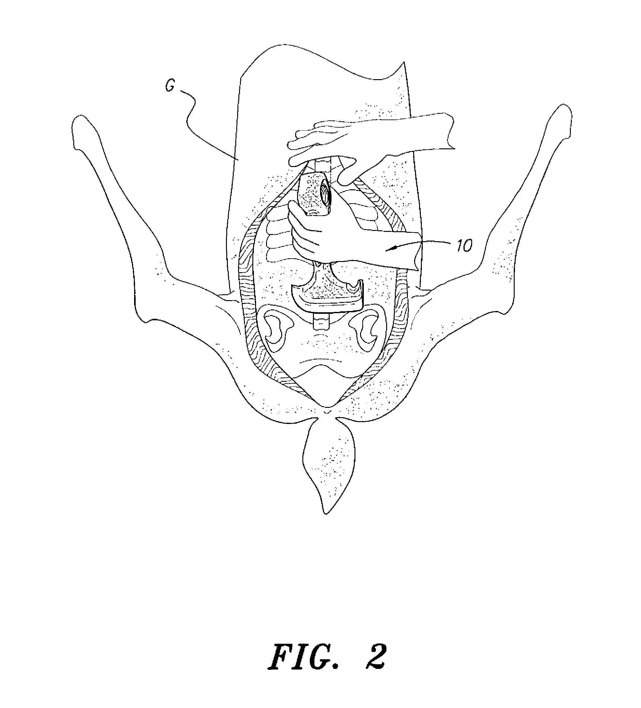 Game field dressing tool