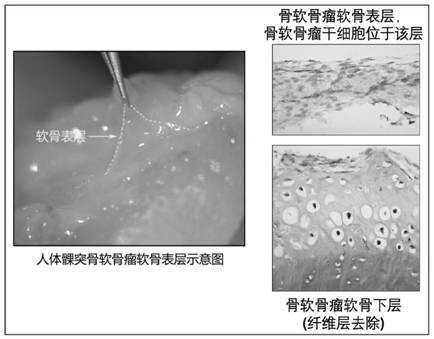 Primary isolation culture method of condylar cartilage stem cells