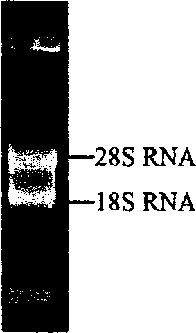 Medusa cystatin gene, and expression and use thereof