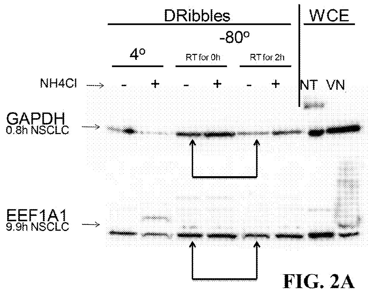 Allogeneic autophagosome-enriched composition for the treatment of disease