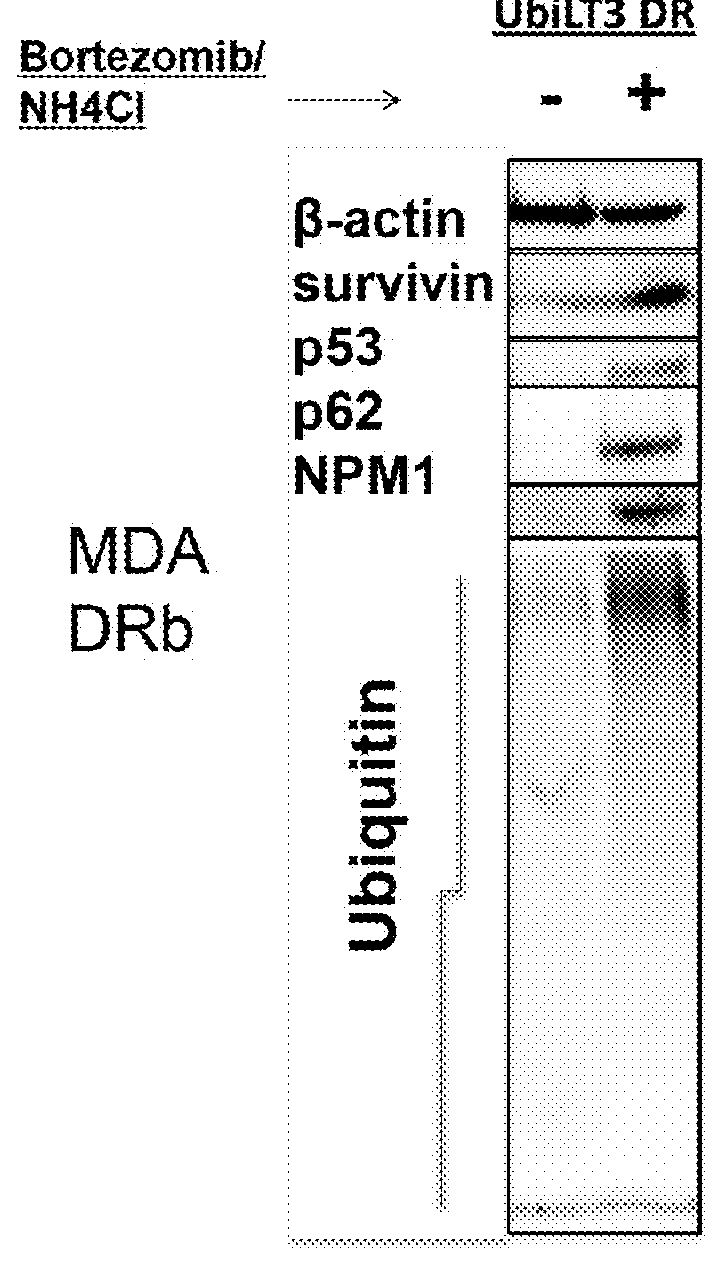 Allogeneic autophagosome-enriched composition for the treatment of disease