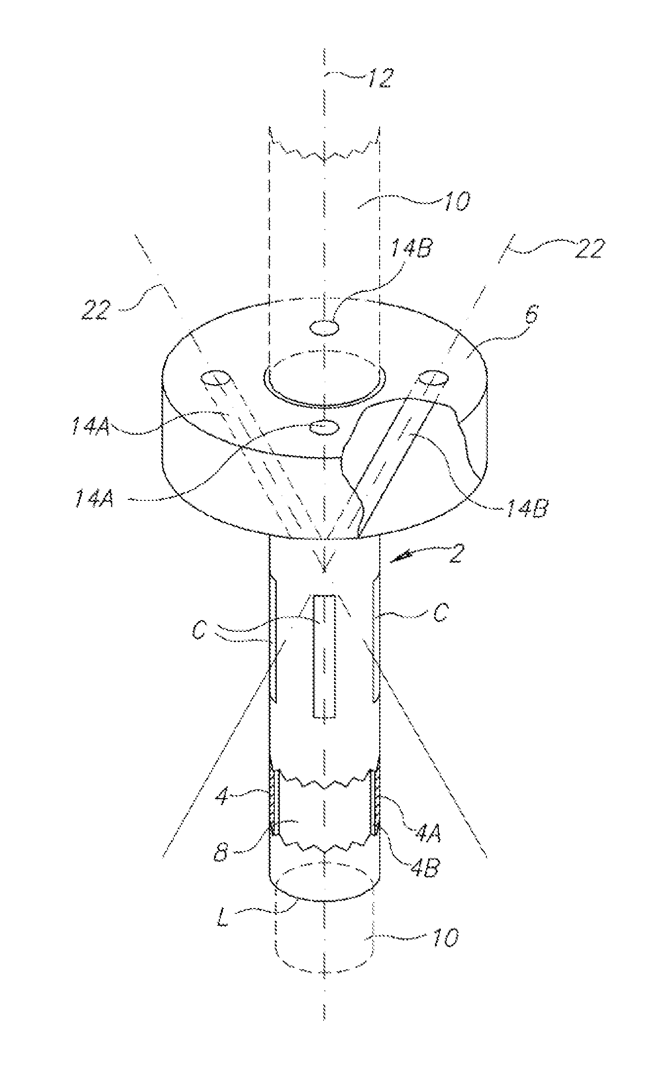 Device for Wound Suturing and Hemostasis in the Thoracic and The Abdominal Wall Mainly in Endoscopic Operations