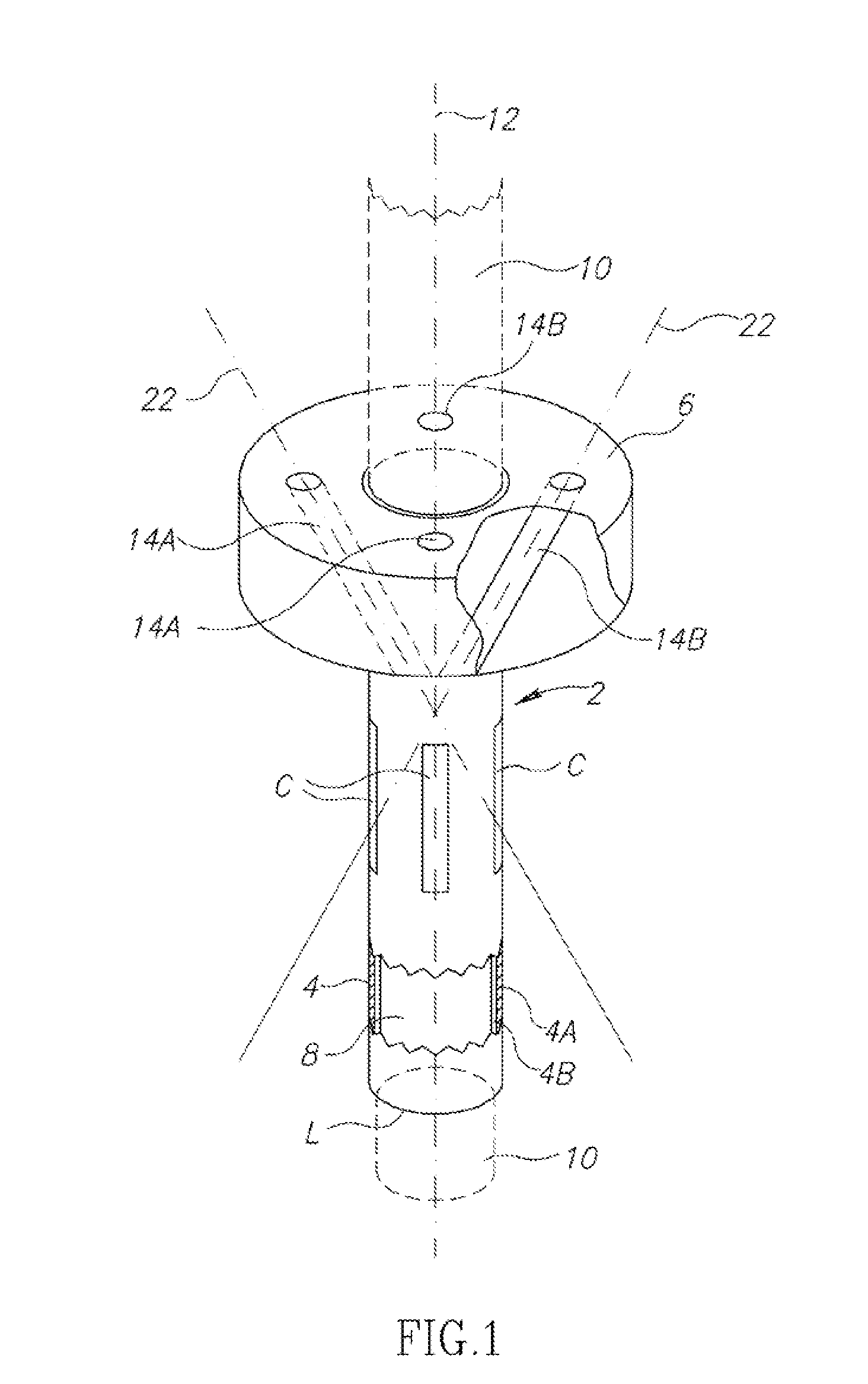 Device for Wound Suturing and Hemostasis in the Thoracic and The Abdominal Wall Mainly in Endoscopic Operations