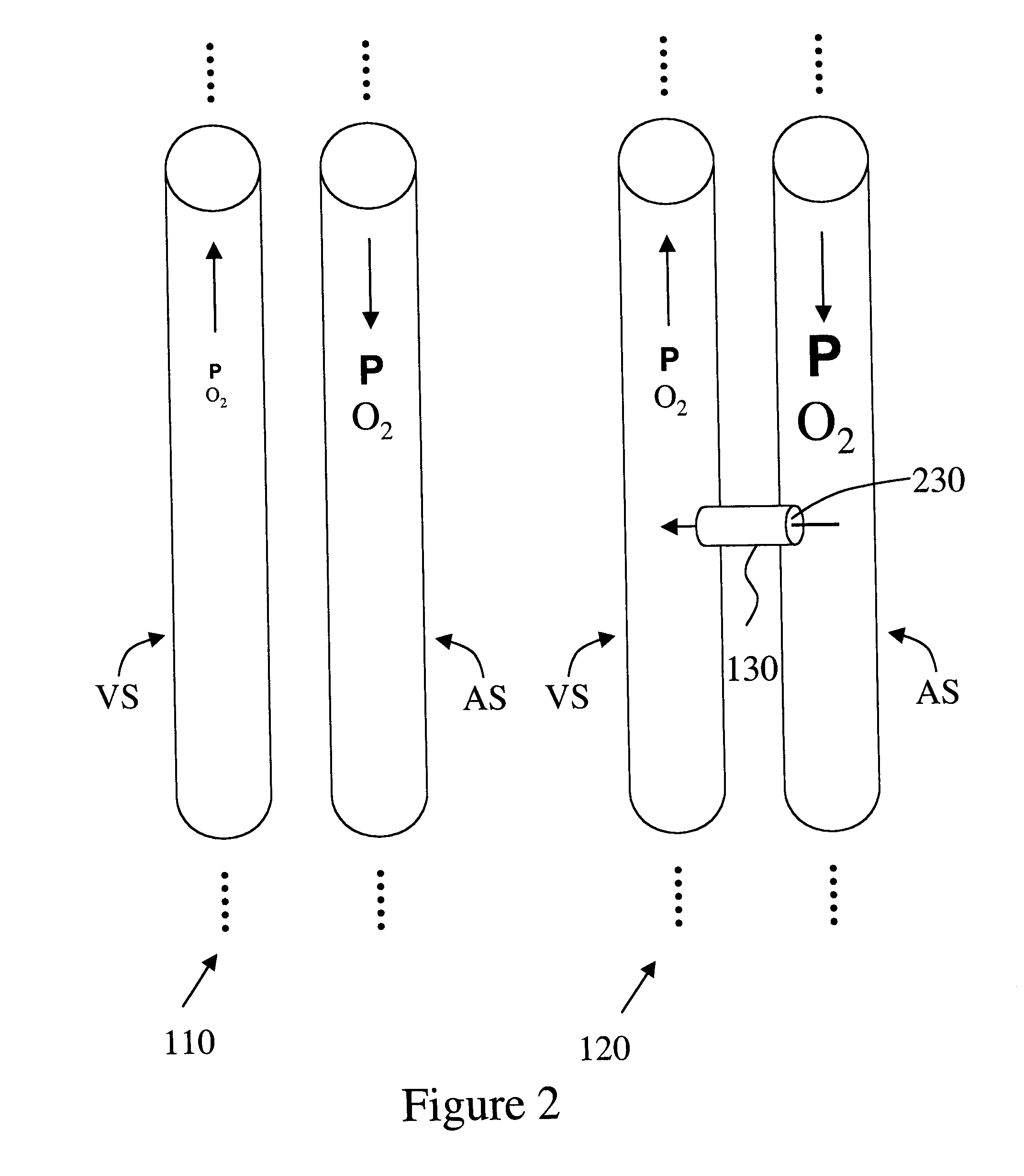 Implantable arterio-venous shunt devices and methods for their use