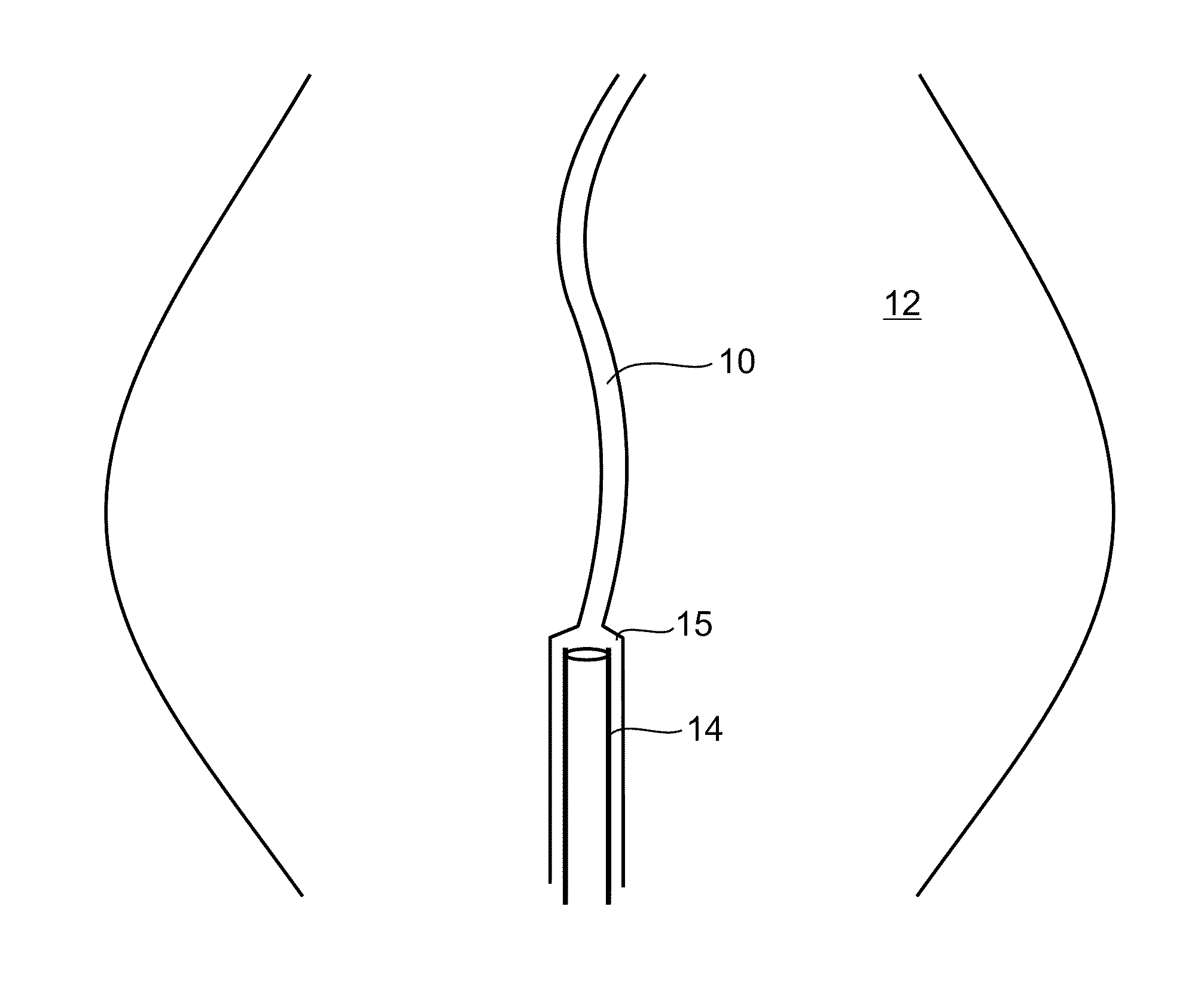 Methods and devices for urethral treatment