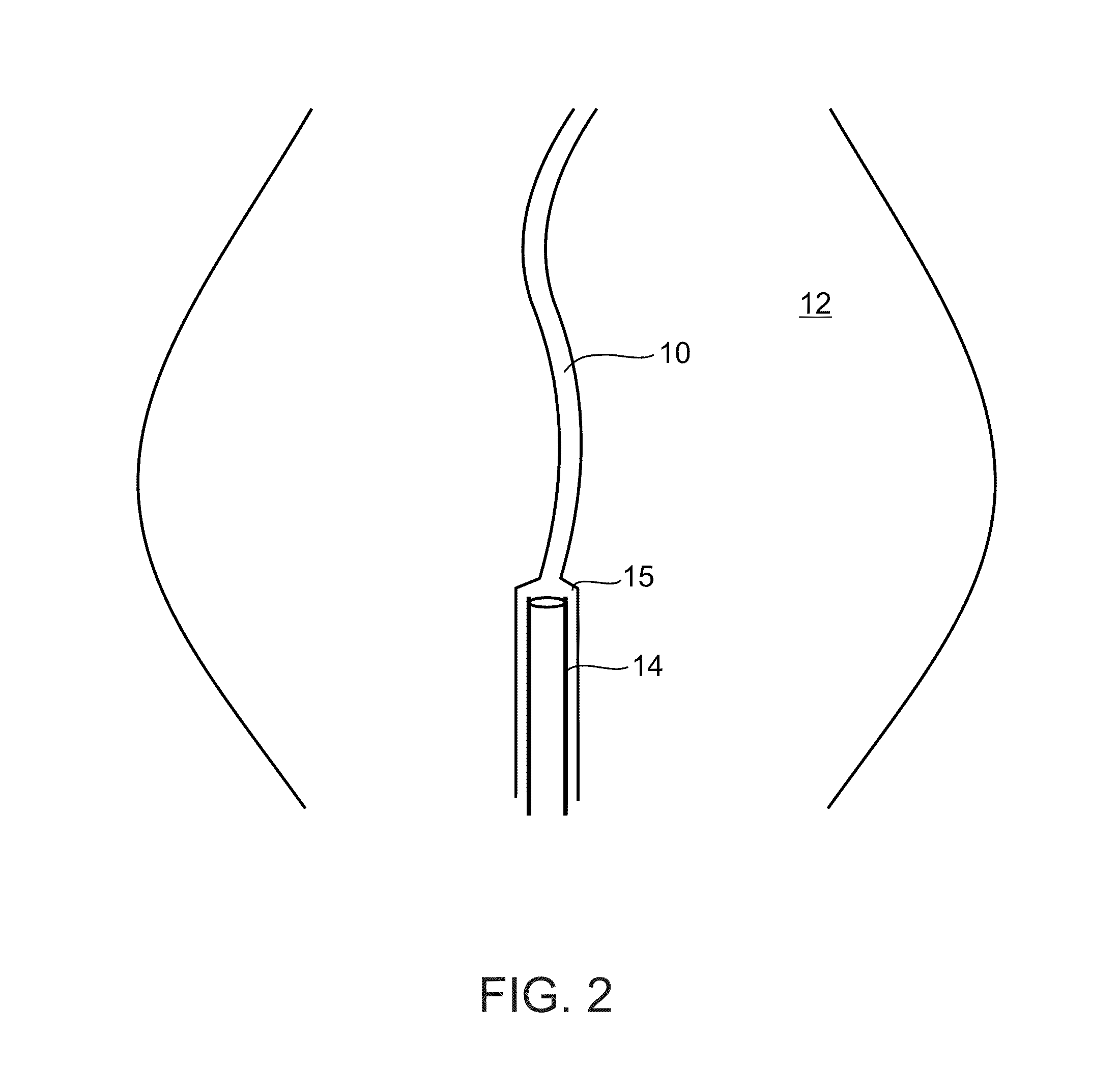 Methods and devices for urethral treatment