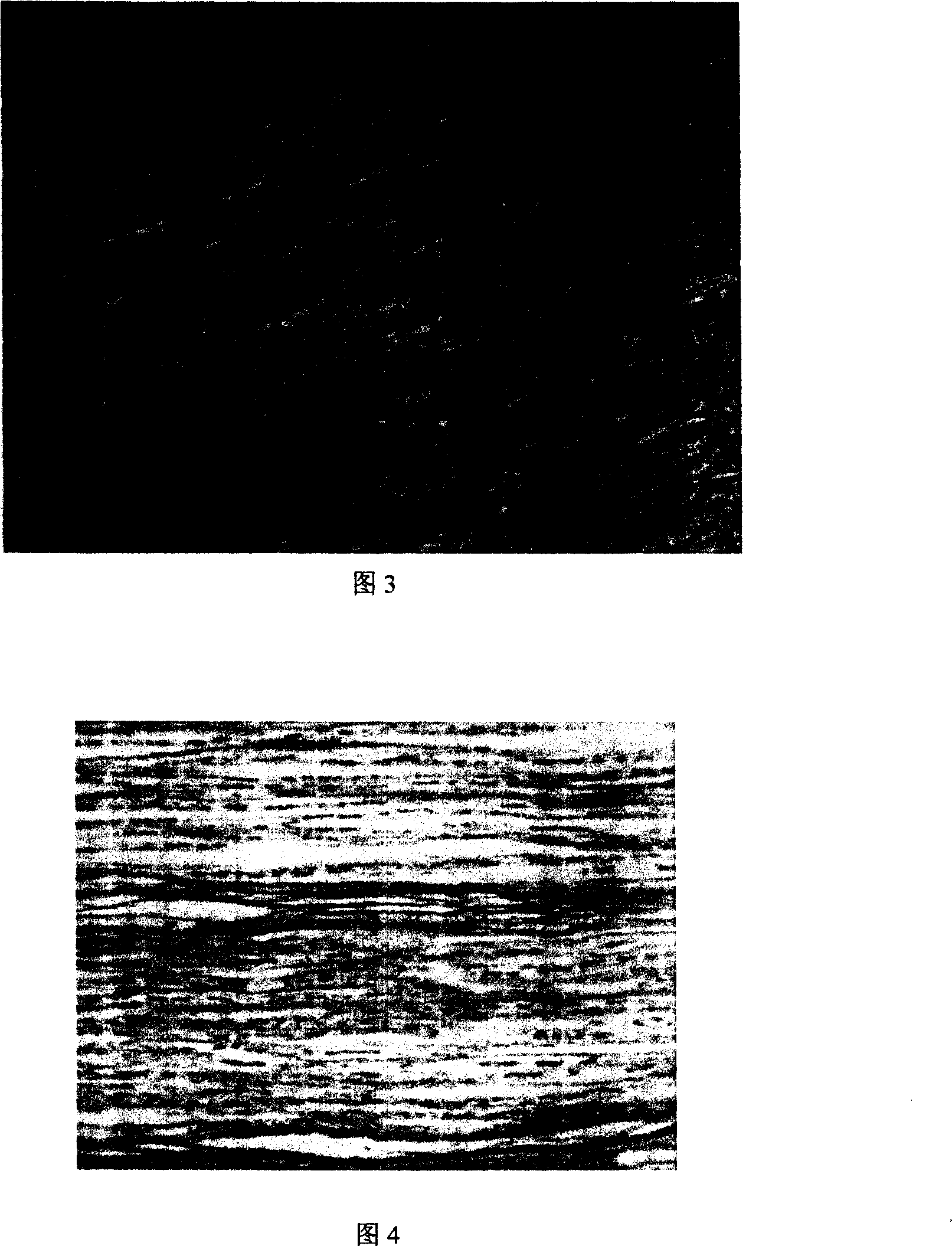 Allograft nerve graft, the method for preparing the same and uses thereof