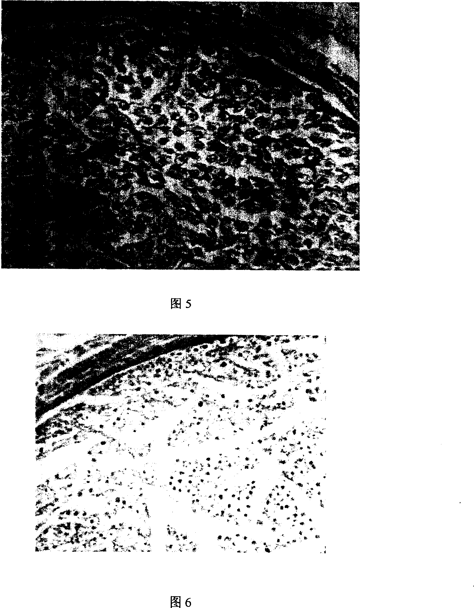 Allograft nerve graft, the method for preparing the same and uses thereof