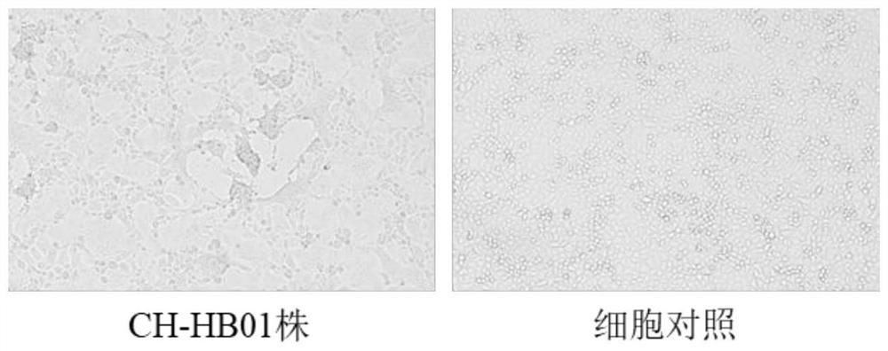 Porcine epidemic diarrhea and porcine rotavirus bivalent inactivated vaccine and preparation method thereof