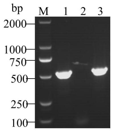 Porcine epidemic diarrhea and porcine rotavirus bivalent inactivated vaccine and preparation method thereof