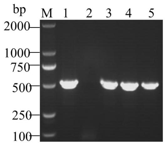 Porcine epidemic diarrhea and porcine rotavirus bivalent inactivated vaccine and preparation method thereof