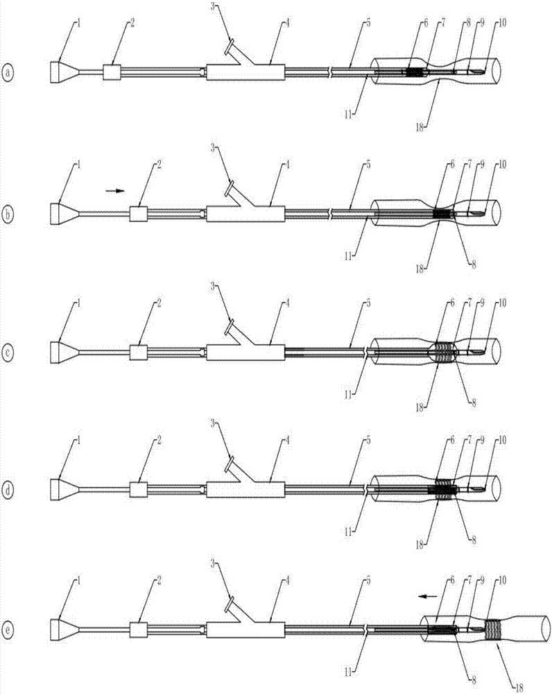 Optical and ultrasonic image diagnosis and treatment effect integrated stent delivery system