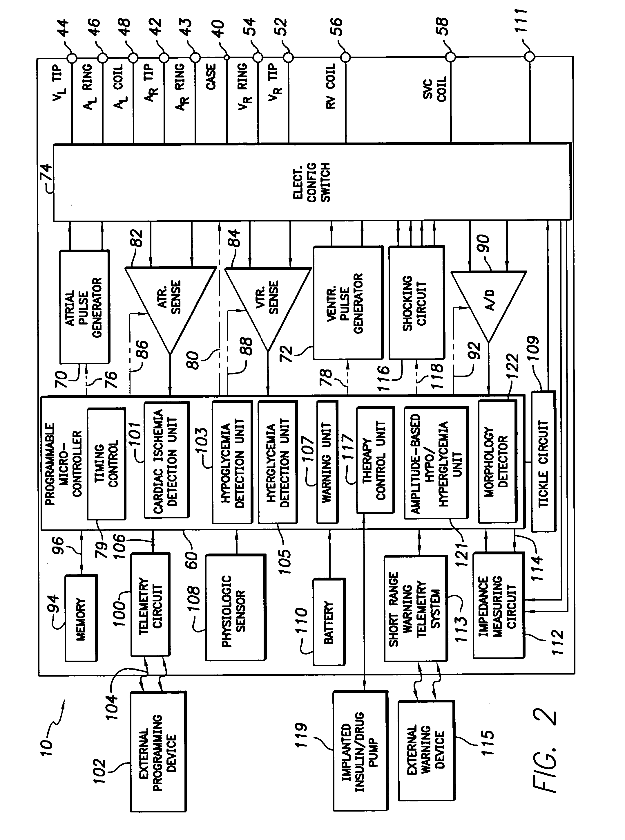 System and method for distinguishing between hypoglycemia and hyperglycemia using an implantable medical device