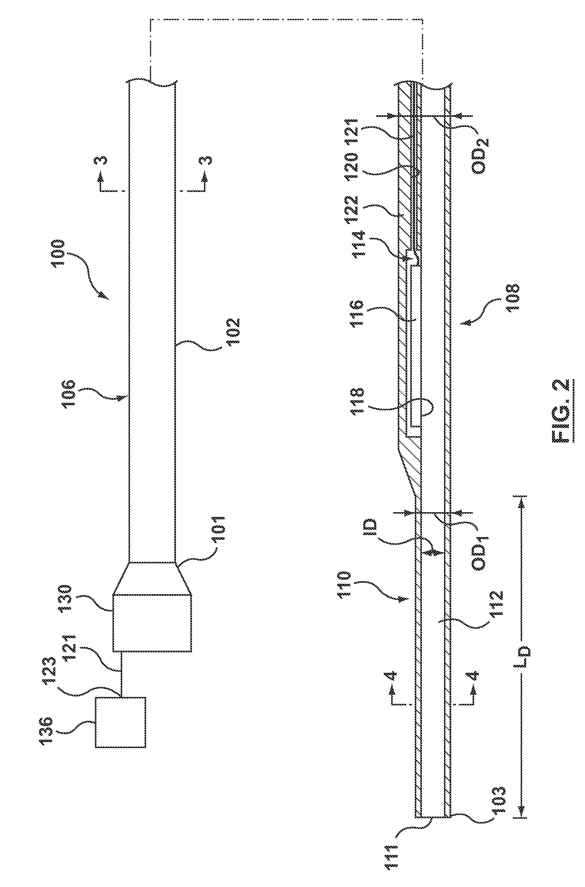 Catheter With Inner Surface Pressure Sensor for Providing a Vascular Pressure Measurement for Determining Fractional Flow Reserve