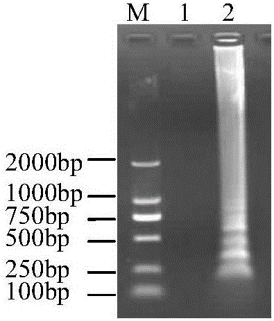 Cymbidium mosaic virus RT-LAMP (reverse transcription-loop-mediated isothermal amplification) detection primers and detection method thereof