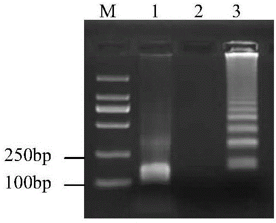 Cymbidium mosaic virus RT-LAMP (reverse transcription-loop-mediated isothermal amplification) detection primers and detection method thereof