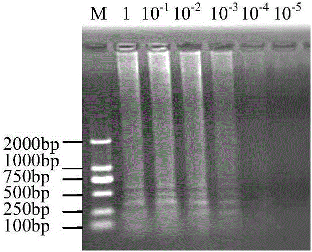 Cymbidium mosaic virus RT-LAMP (reverse transcription-loop-mediated isothermal amplification) detection primers and detection method thereof