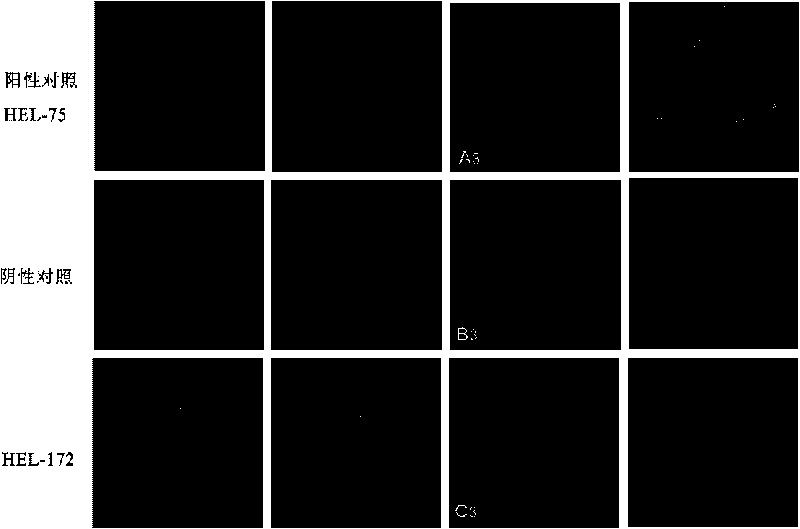 Human epididymis expression sperm binding protein HEL-172 as well as encoding gene and application thereof