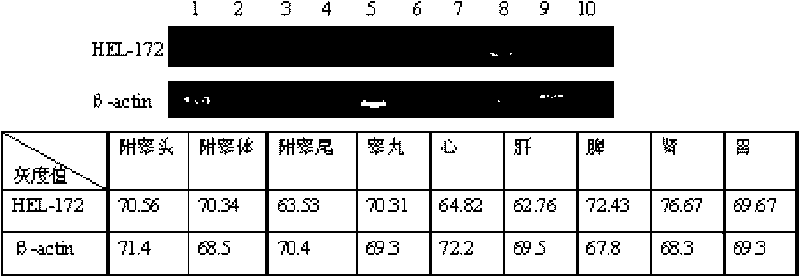 Human epididymis expression sperm binding protein HEL-172 as well as encoding gene and application thereof