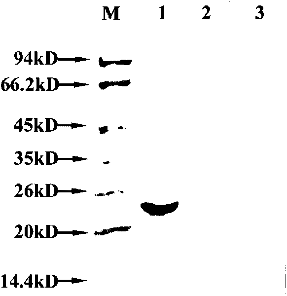 Human epididymis expression sperm binding protein HEL-172 as well as encoding gene and application thereof