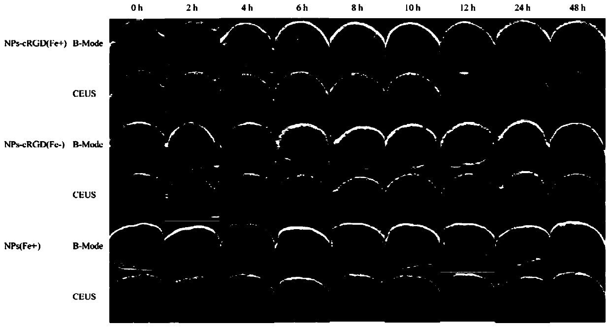 Targeted ultrasonic phase-change bimodal imaging nano contrast agent and preparation method and application thereof