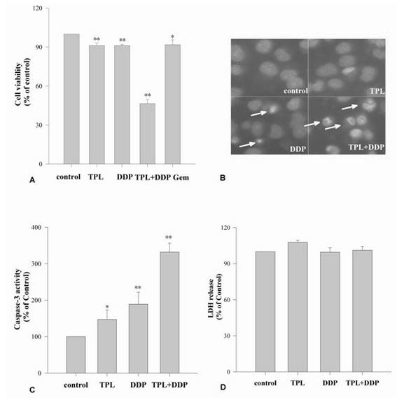 Application of combined utilization of triptolide cisplatin in preparation of pancreatic cancer drug against drug resistance