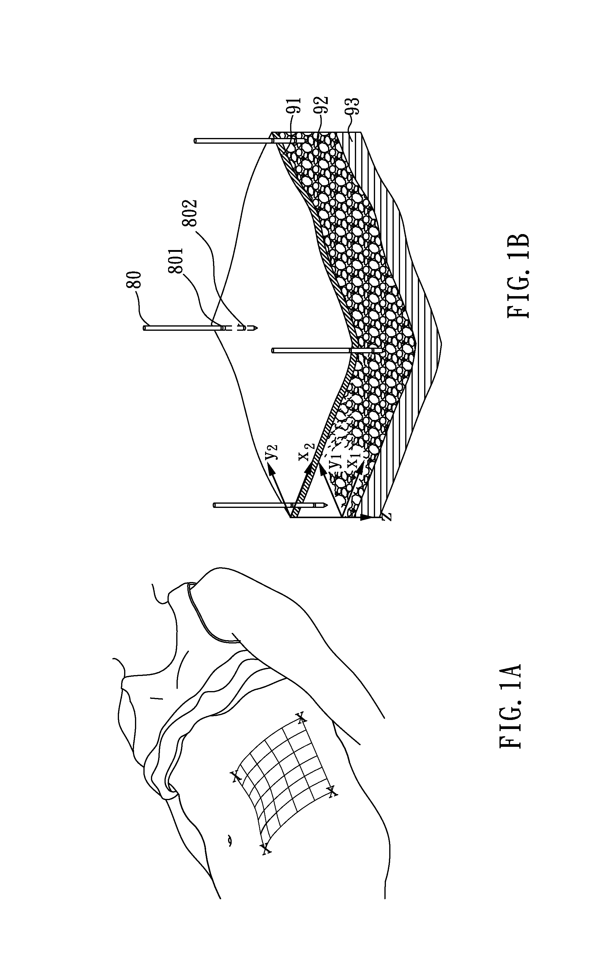 Automatic Fat Removal Device