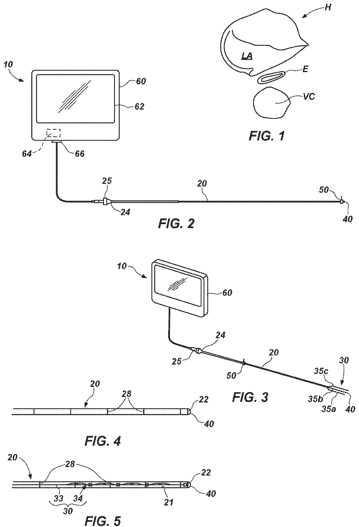 Esophageal monitoring