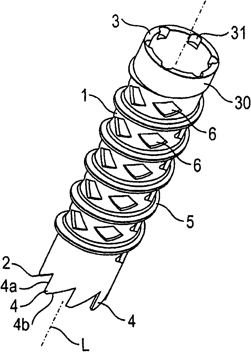 Bone screw