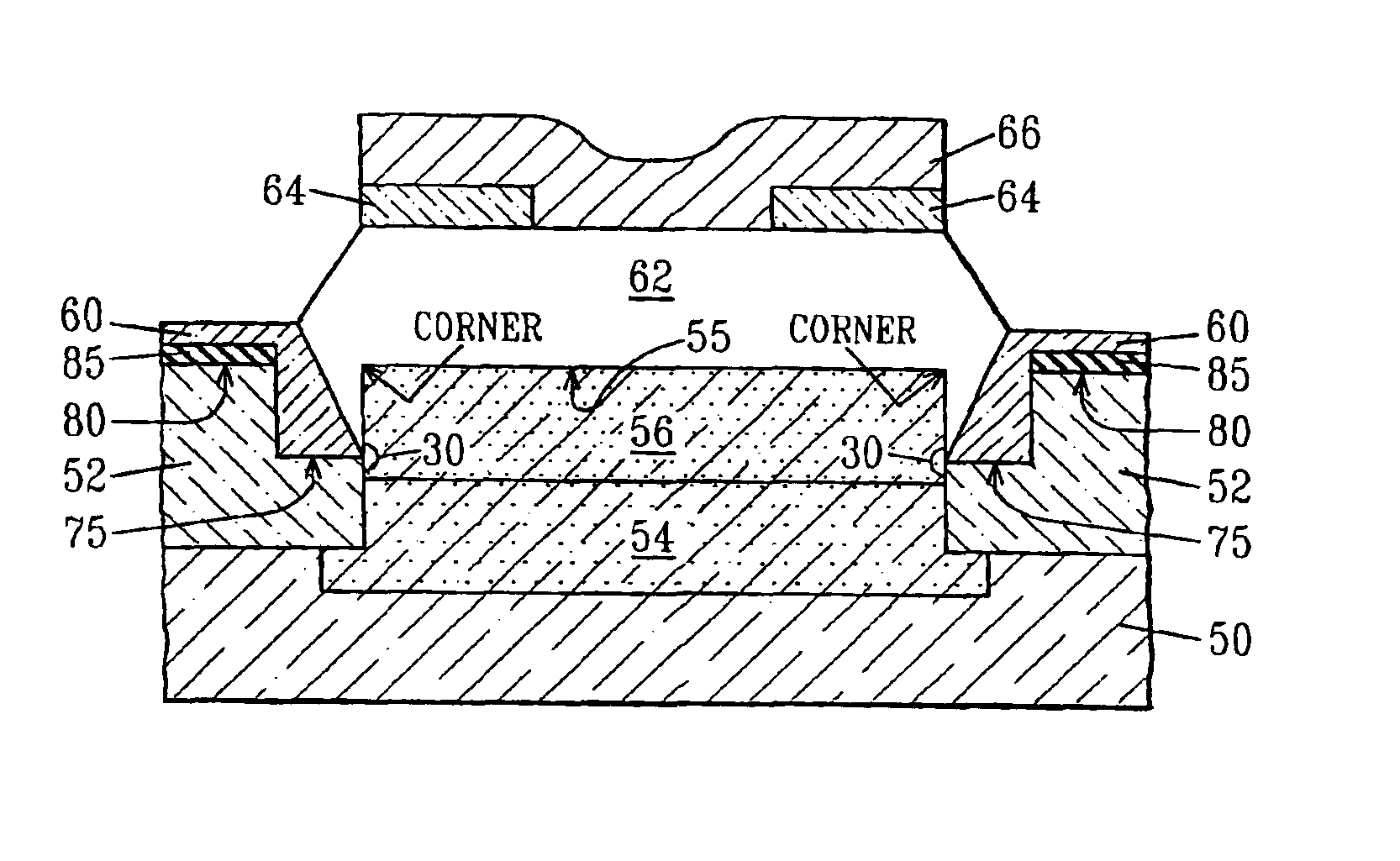 STI pull-down to control SiGe facet growth