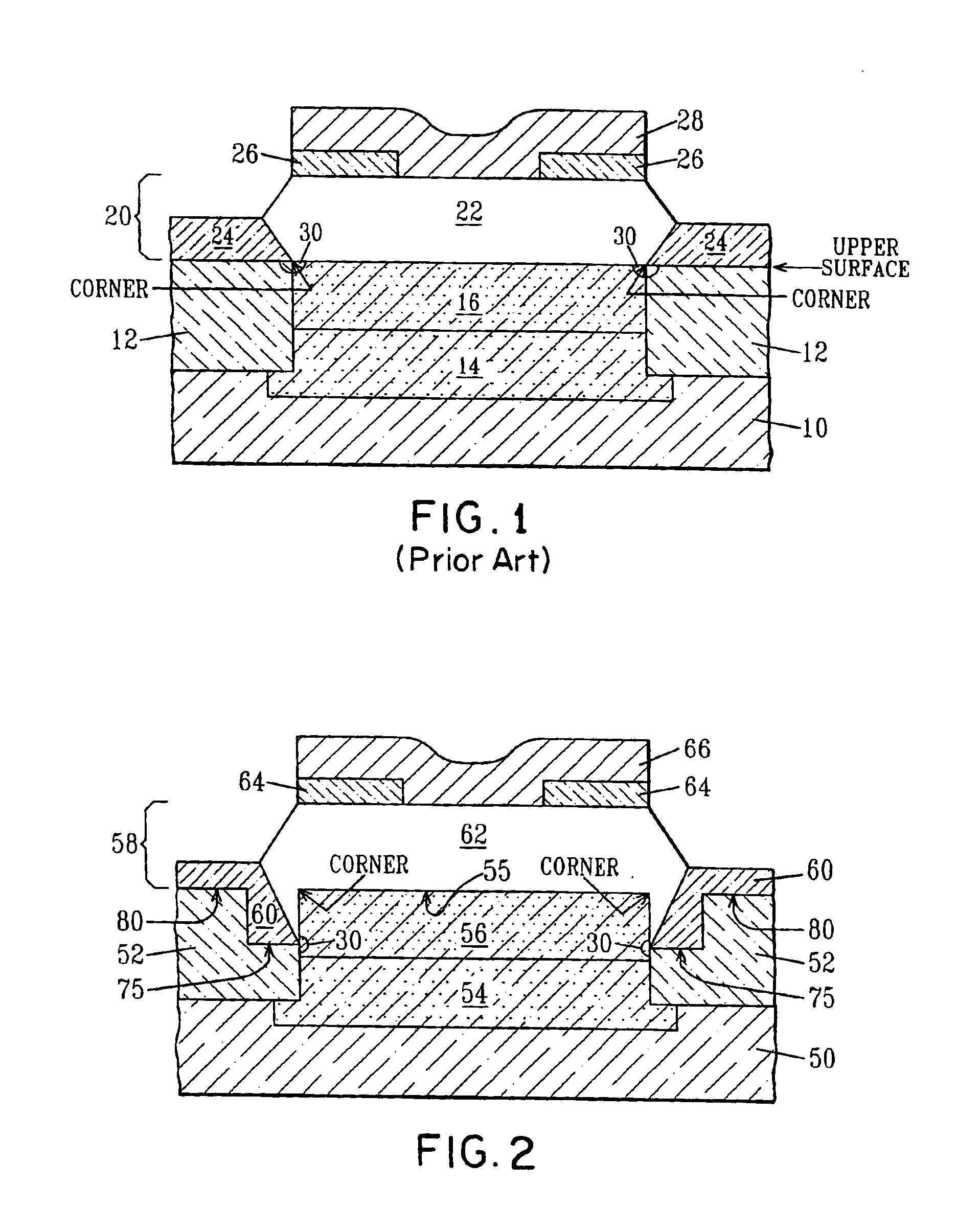 STI pull-down to control SiGe facet growth