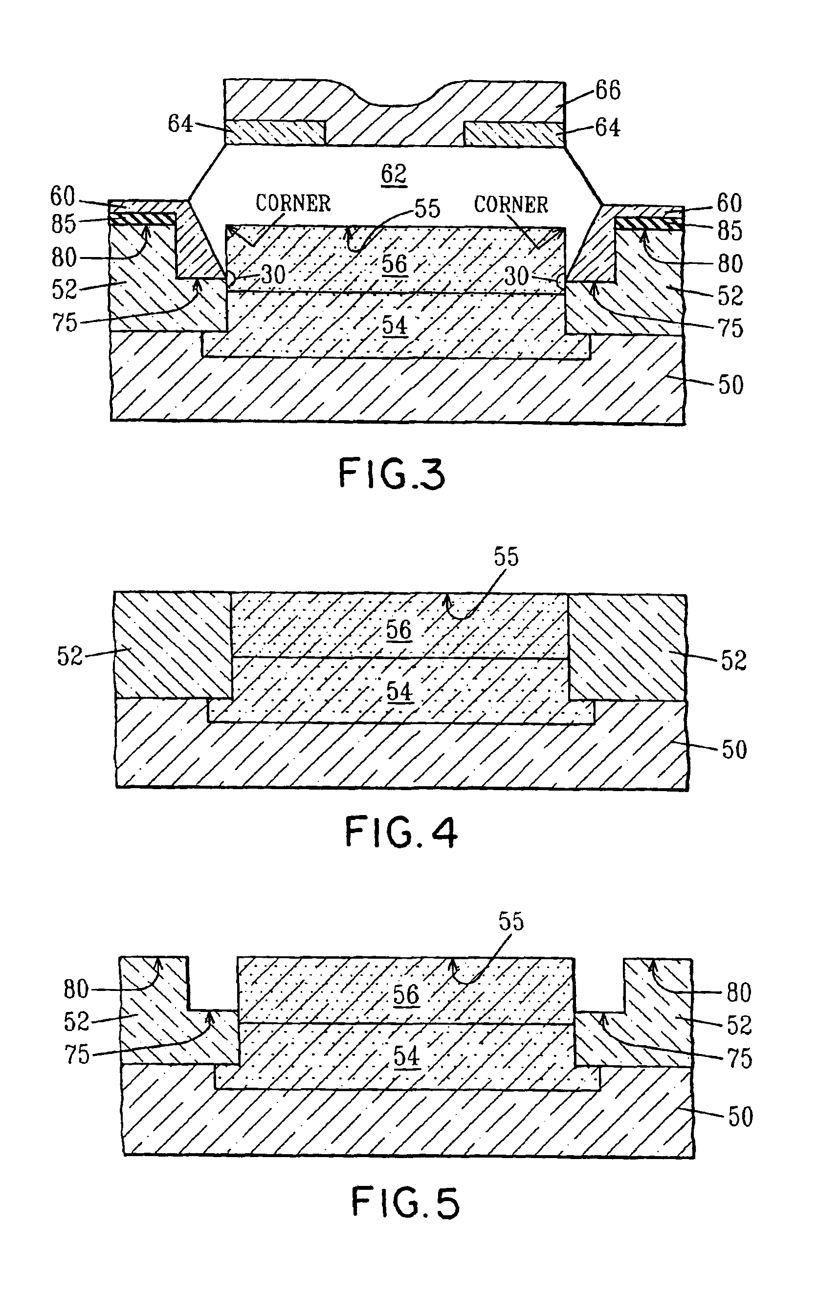 STI pull-down to control SiGe facet growth