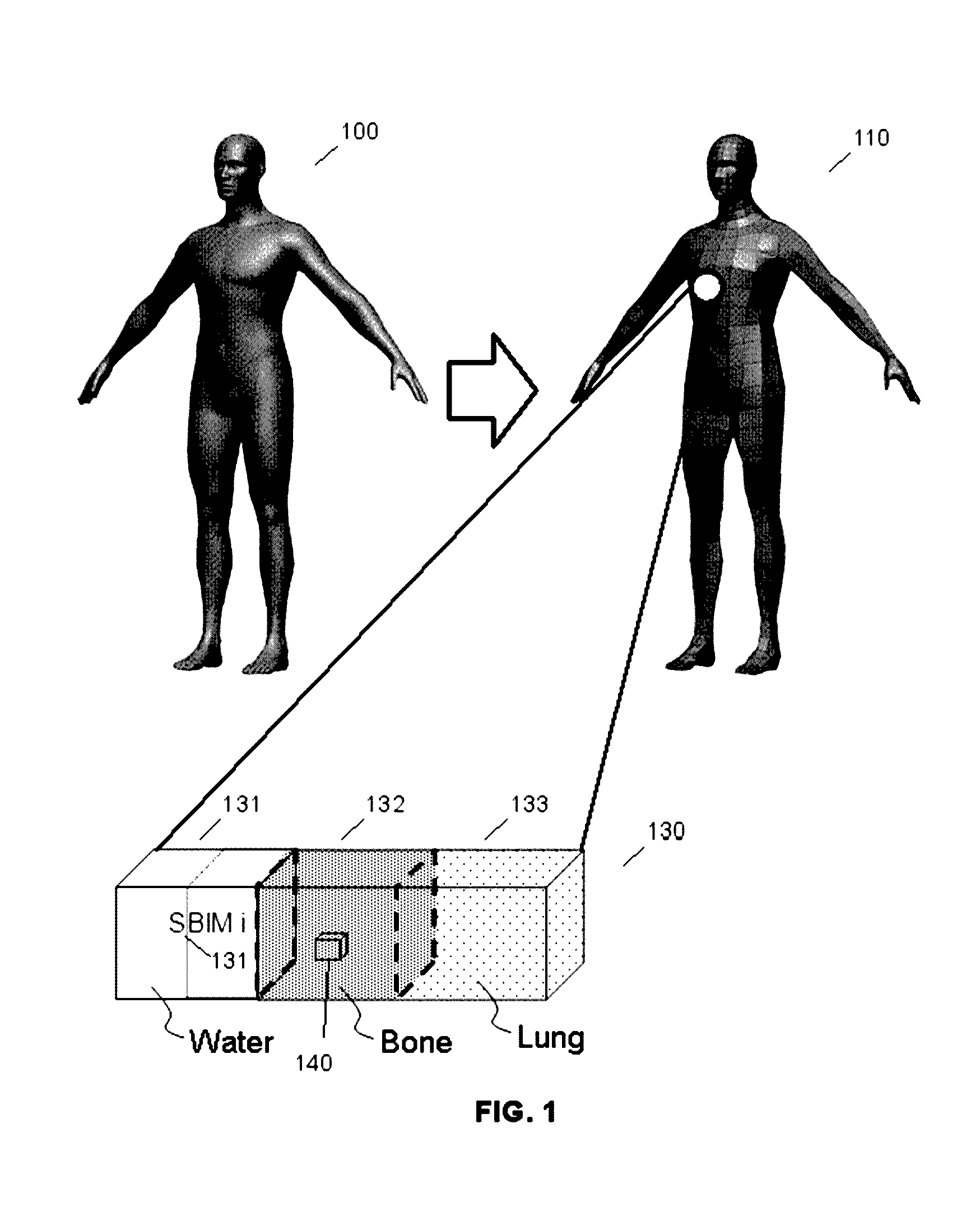 Optimisation of a method for calculating doses deposited by an ionising beam