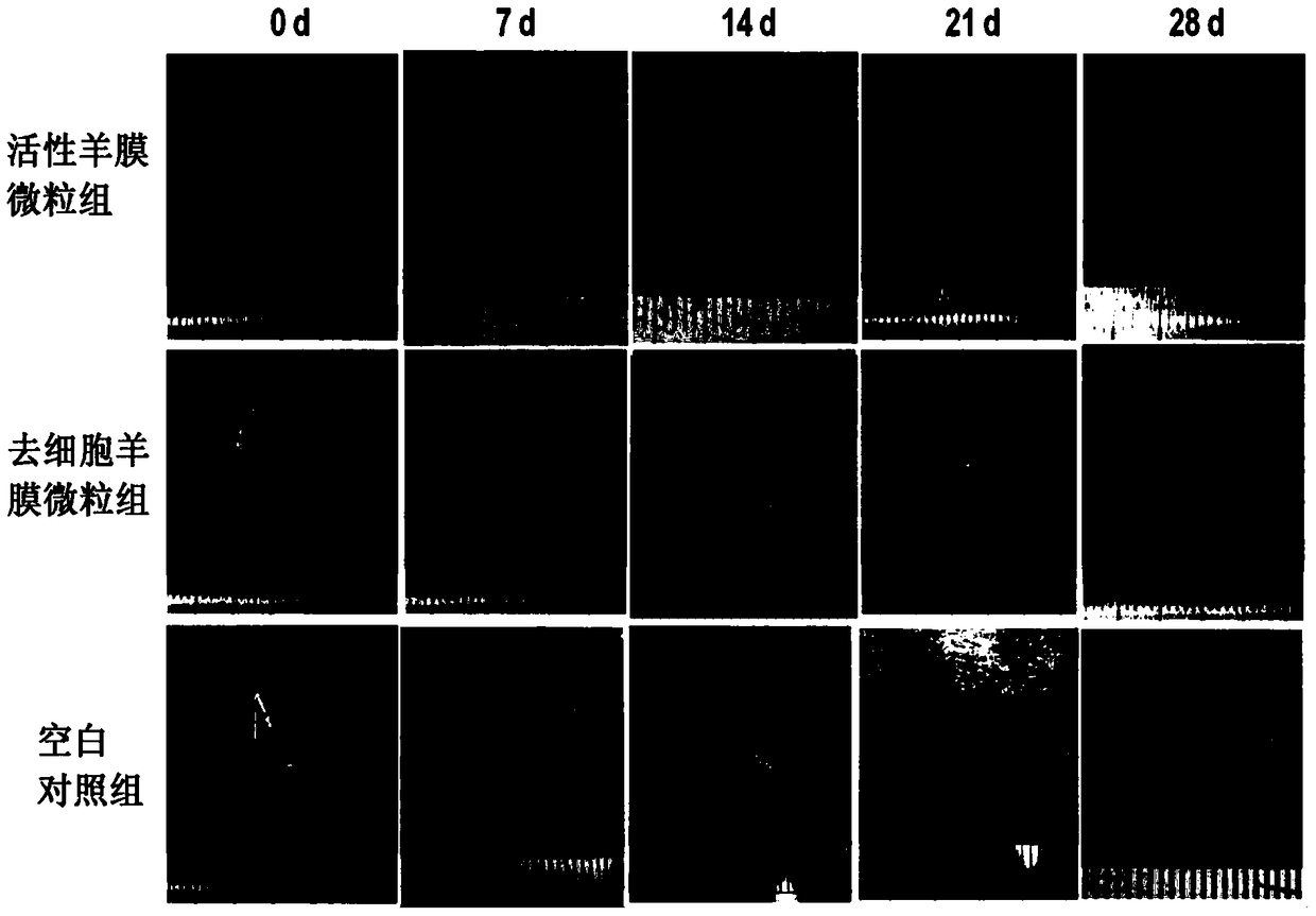 Freeze-viable amnion microparticles loaded with amnion intrinsic stem cells and their conditioned medium and application