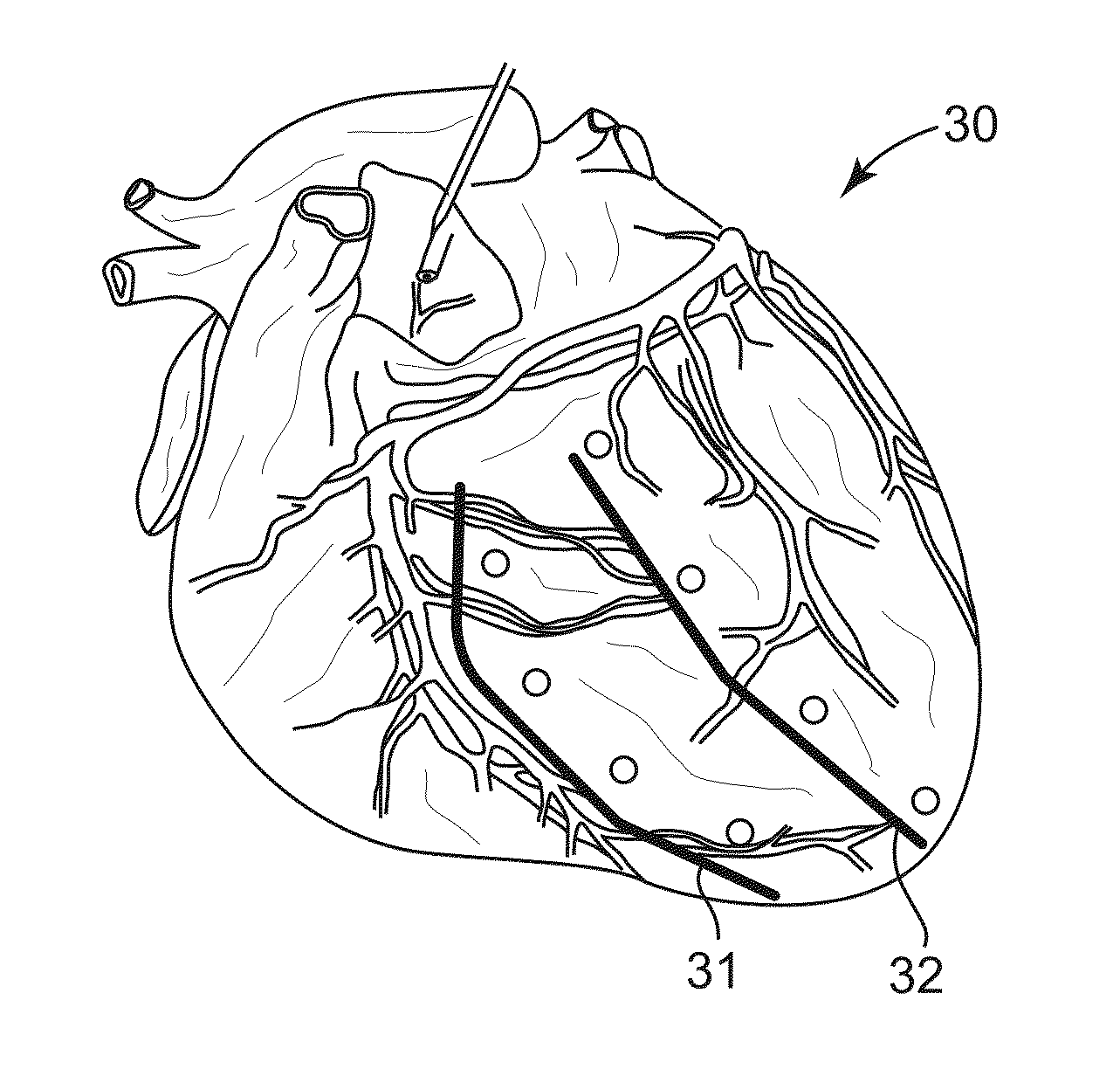 Cardiac Patterning for Improving Diastolic Function