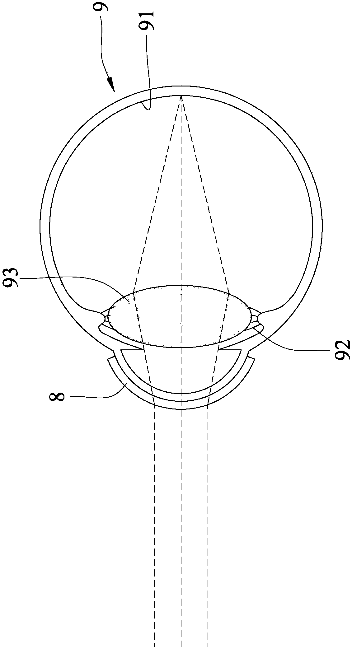 Continuous zooming contact lens