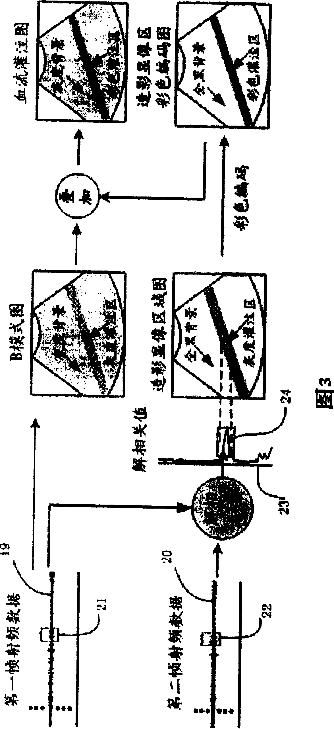 System and method of perfusion imaging and ultrasonic control releasing based-on capsule microbubble