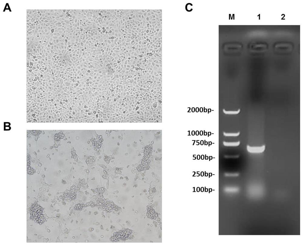 Porcine epidemic diarrhea, porcine delta coronavirus dual attenuated vaccine and preparation method thereof